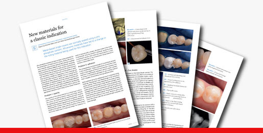 New materials for a classic indication