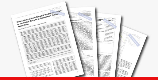 Meta Analysis of the Influence of Bonding Parameters