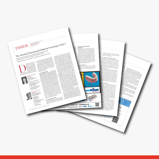 The Bonded Functional Esthetic Prototype Part 1 1