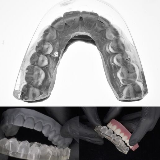 Resinas directas inyectadas dsd direct 02
