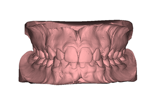 STL models in occlusion