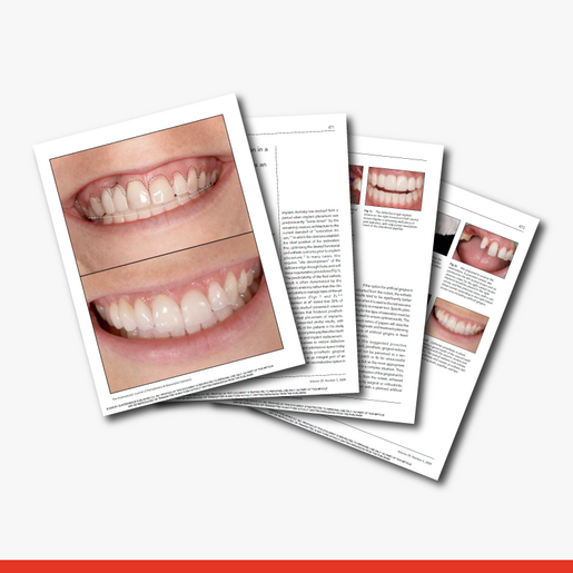 Prosthetic Gingival Reconstructio Part 1