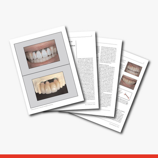 Prosthetic Gingival Reconstructio Part 3