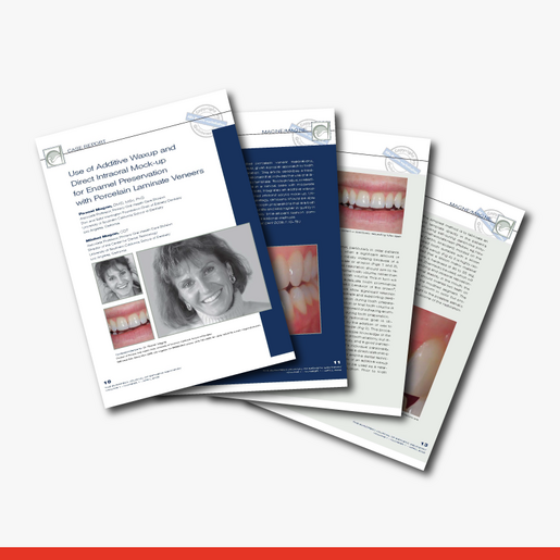 Use of Additive Waxup and Direct Intraoral