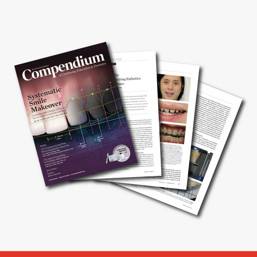 Digital Smile Design Meets the Dento Facial Analyzer