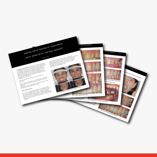 Daily Work with the DSD Concept