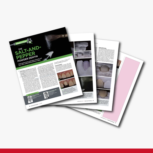 Achieving the ideal combination of opacity and colour with a milled disilicate lithium coping A comprehensive approach for restoring esthetics