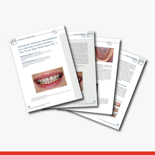 Full Mouth Adhesive Rehabilitation