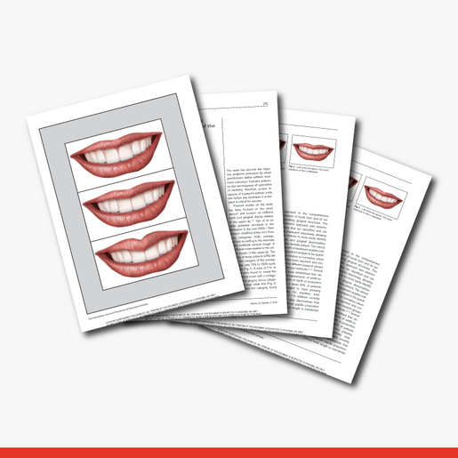 Maxillary Anterior Papilla Display