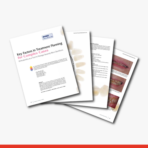 Key Factors in Treatment Planning for Complex Cases