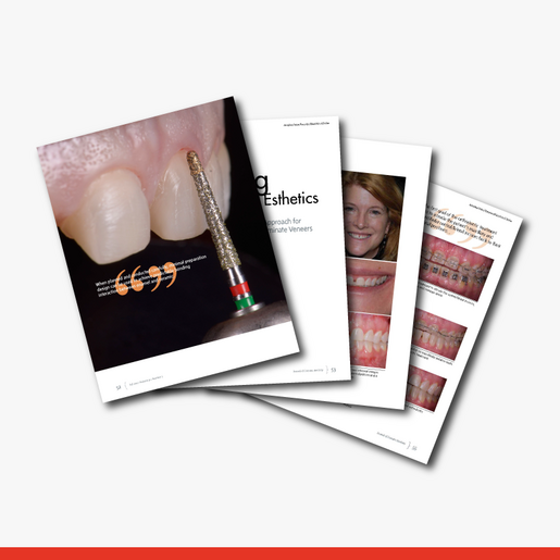 Pursuing Conservative Esthetics