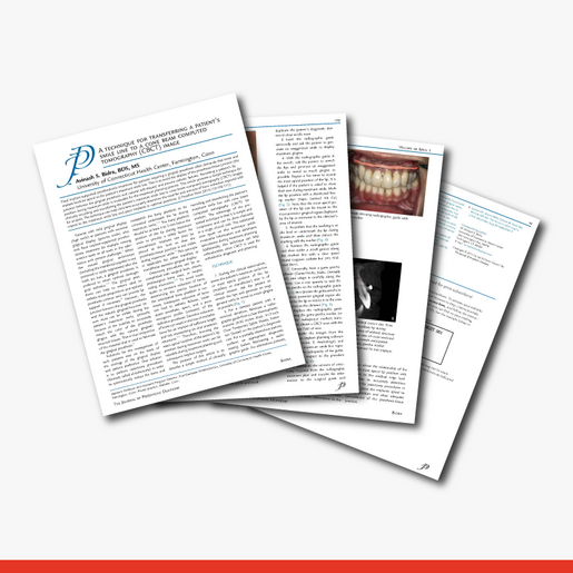 A technique for transferring a patients smile line