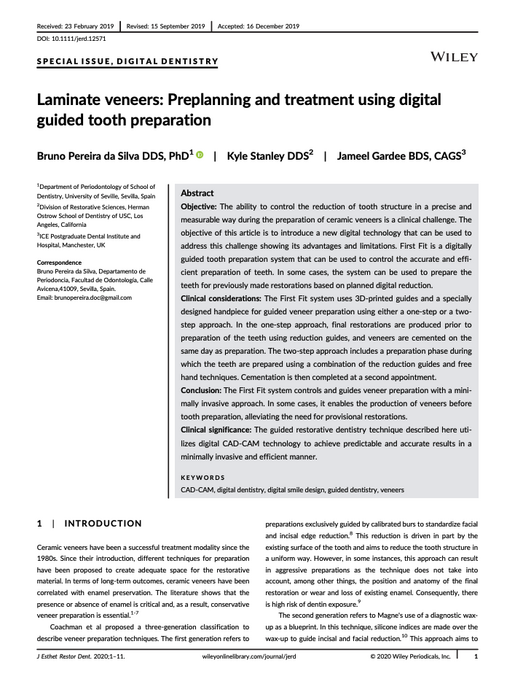 Laminate veneers Preplanning and treatment using digitalguided tooth preparation