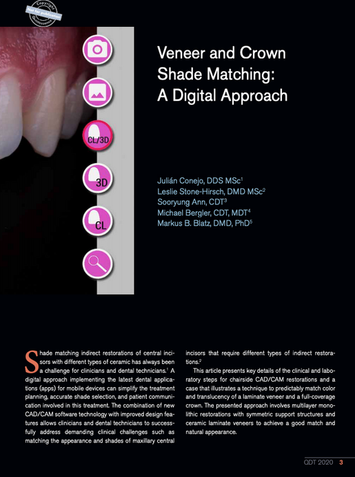 Veneer and Crown Shade Matching A Digital Approach