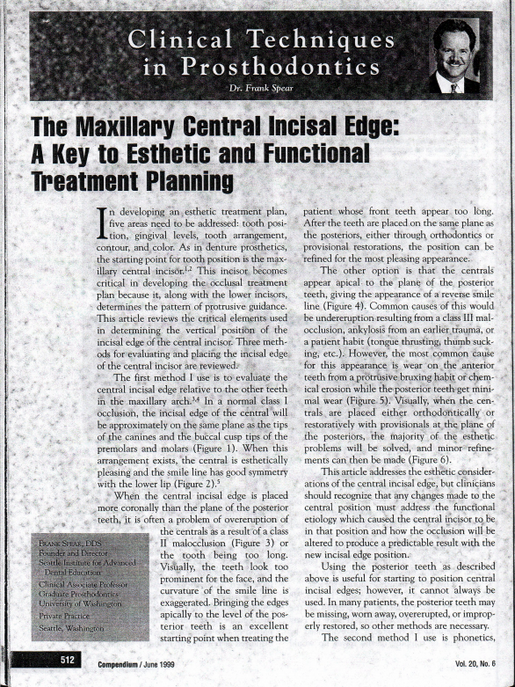 The Maxillary Central Incisal Edge