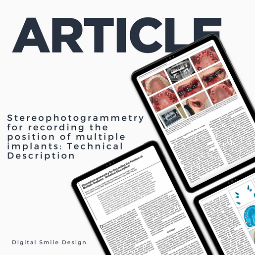 SQUARE thumbnail I Stereophotogrammetry for recording the position of multiple implants technical description