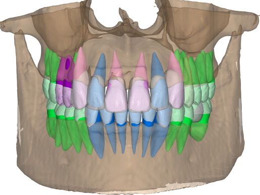 Ortho planning tps