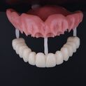 Denture dsd 1