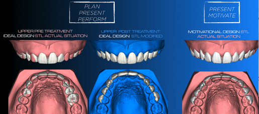 Three DSD models