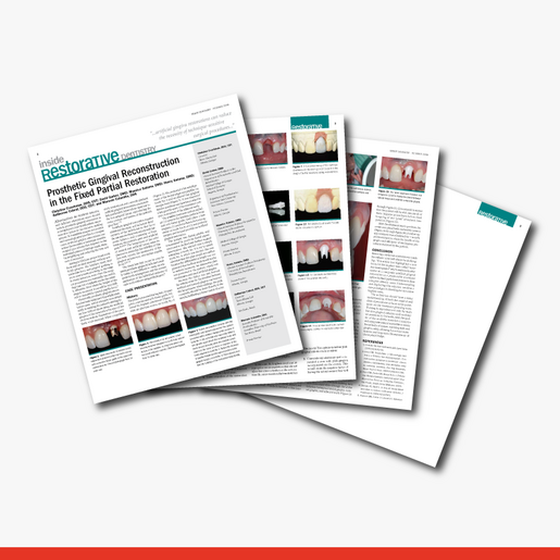 Prosthetic Gingival Reconstruction