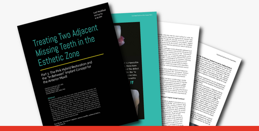 Treating Two Adjacent Missing Teeth part 3