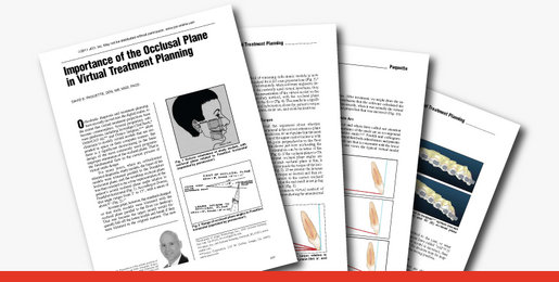 Importance of the Occlusal Plane