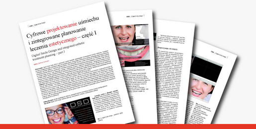 Integrated esthetic treatment planning