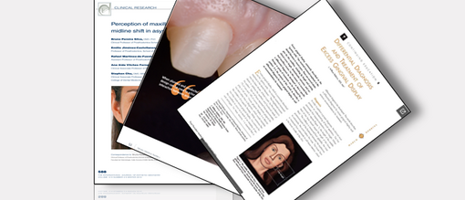 DSD Articles by others 1