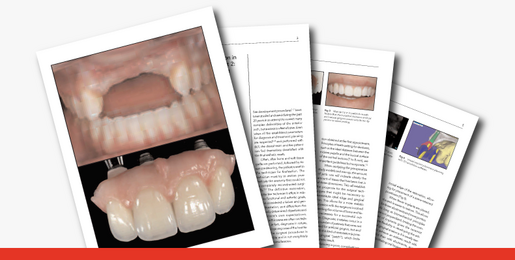 Prosthetic Gingival reconstruction 1