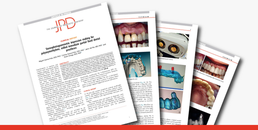 Stereophotogrammetric impression