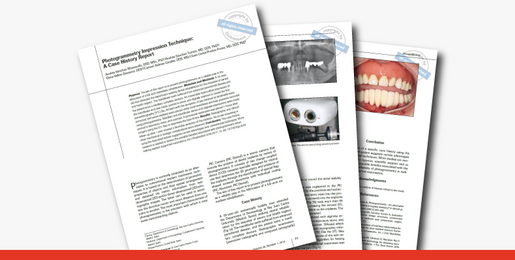 Photogrammetry Impression Techinque 1