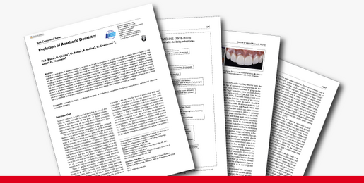 Evolution of Aesthetic Dentistry Ultimate ceramic veneers a laboratory