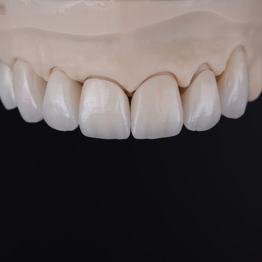 DSC 3232