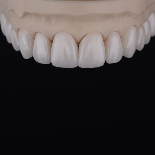 Natural restoration DSD