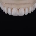 Natural restoration DSD