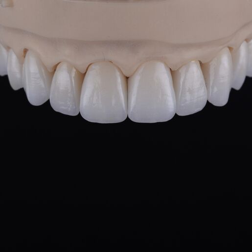Natural restoration DSD2