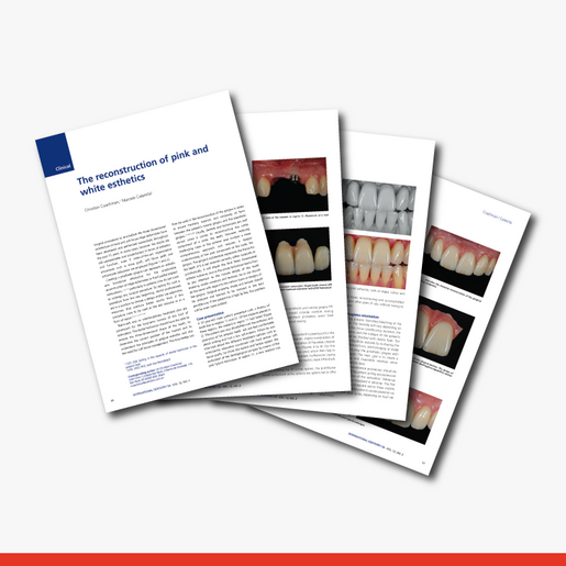 The Reconstruction of Pink and White Esthetics