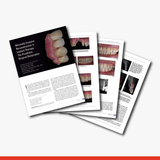 Minimally Invasive Reconstruction