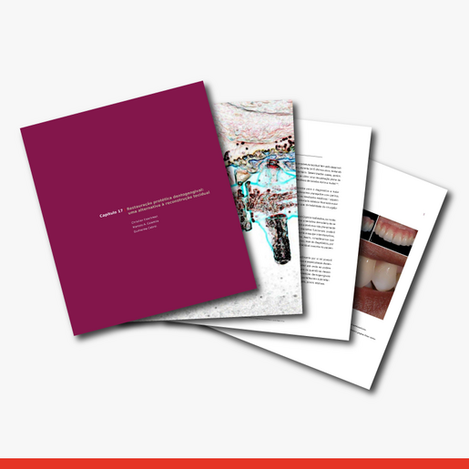 Restauração Protética