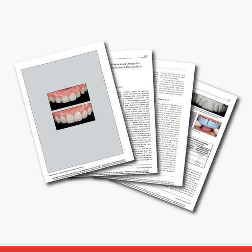 The Influence of Tooth Color