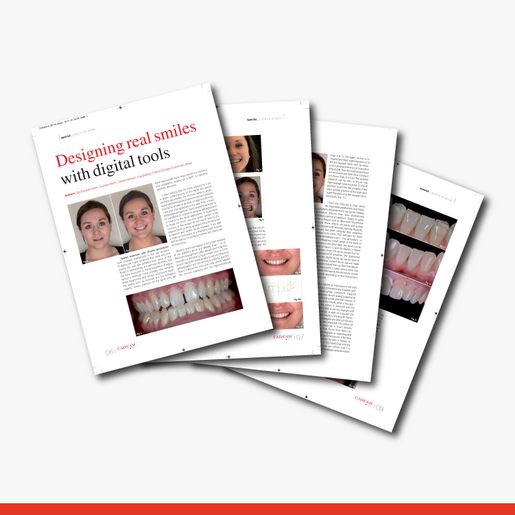 Designing real smiles