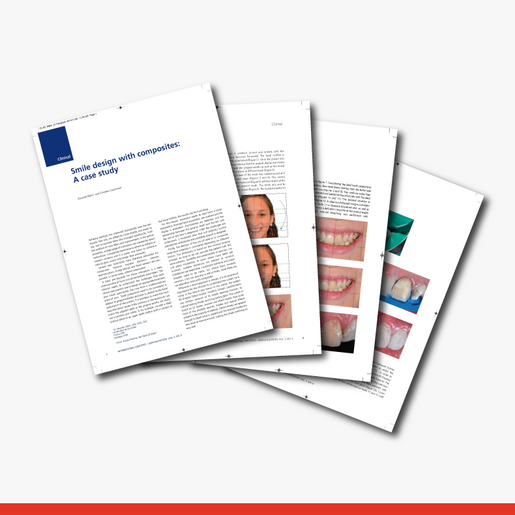 Smile Design with Composite