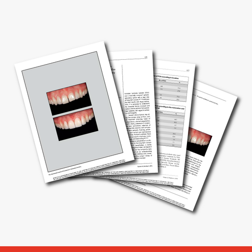 Clinical Performance of Porcelain