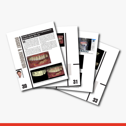 Facially Generated and Cephalometric Guided Digital Wax Up