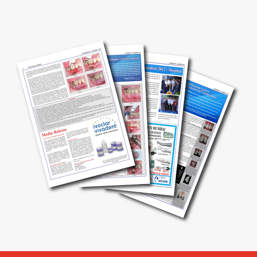 Partial Porcelain Veneers