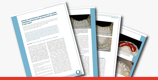 Esthetic and functional rehabilitation