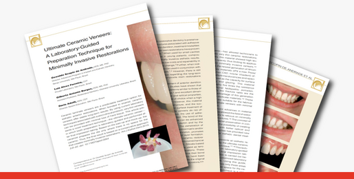 Ultimate ceramic veneers a laboratory 1