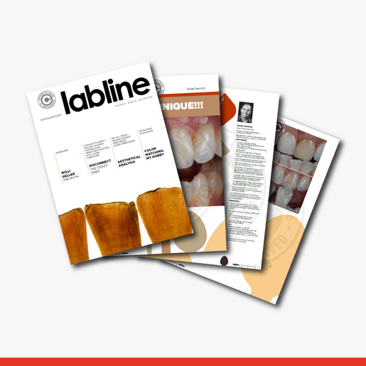 Labline 11 Scoop Technique