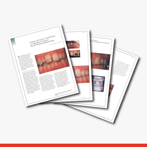 Esthetics and Anterior Tooth Position