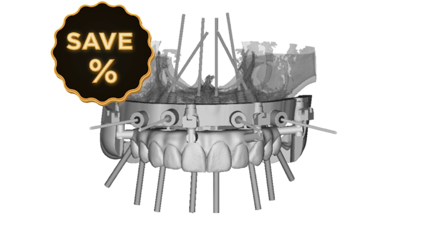 POST CASE ACCEPTANCE DESIGN PRODUCTS DSD Clic Guide Design
